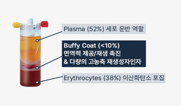 혈액 기반 재생 시스템