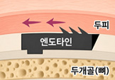 엔도타인 고정 원리