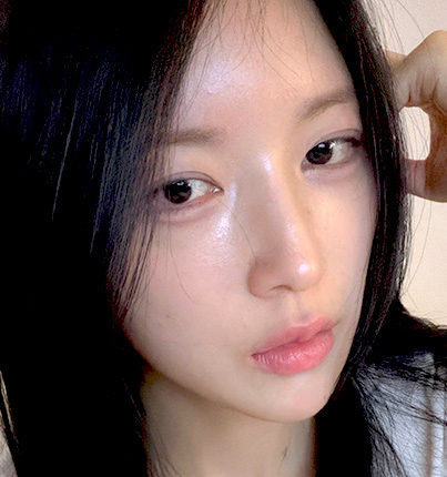 수술 후