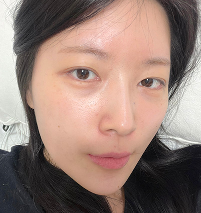 수술 전