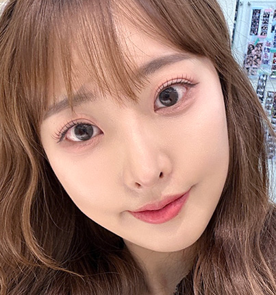 수술 후