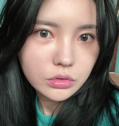 수술 전