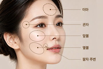 부위별 지방이식