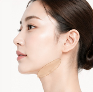 턱라인