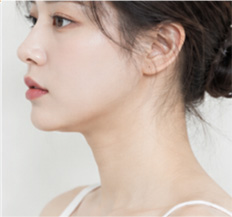 턱선이 흐릿해 보이는 경우