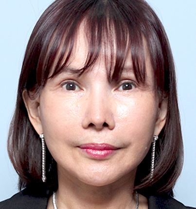 수술 후