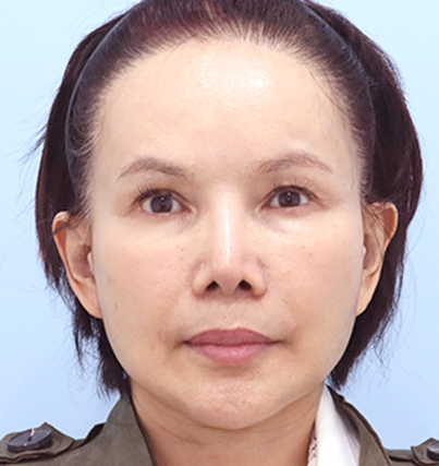 수술 전