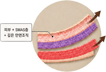 딥플레인 방식 도식