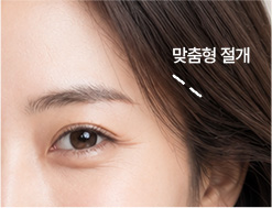 개인별 맞춤 절개