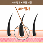모발 방향 고려한 섬세한 절개