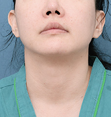 수술 전