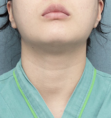 수술 전