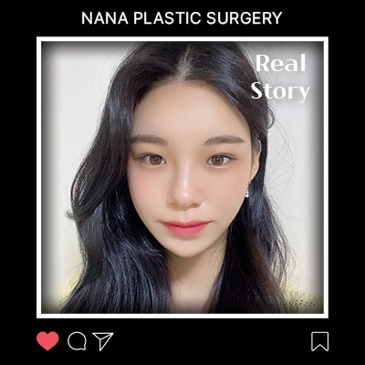 무너진 턱선과 흐릿한 볼 라인, 미니거상으로 정리한 후기 썸네일