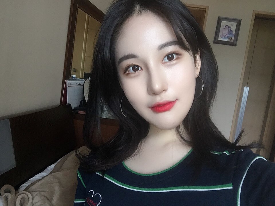 이마거상 수술 후