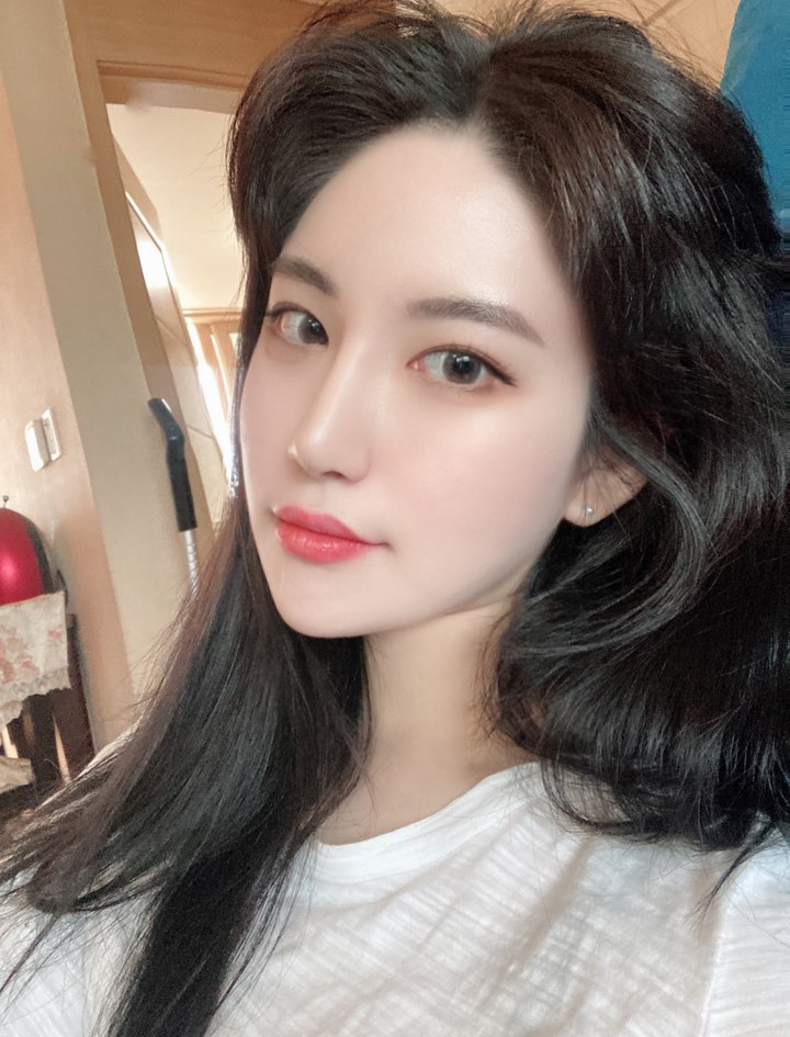 이마거상 수술 후