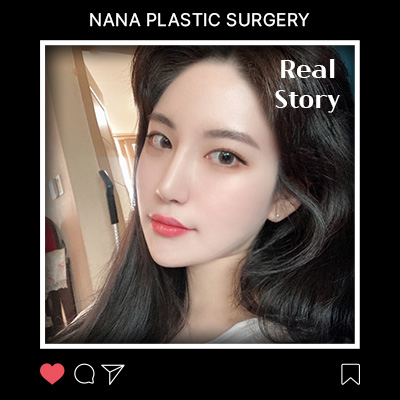 이마거상 리얼후기 썸네일