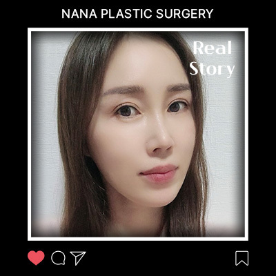 미니거상 리얼후기 썸네일