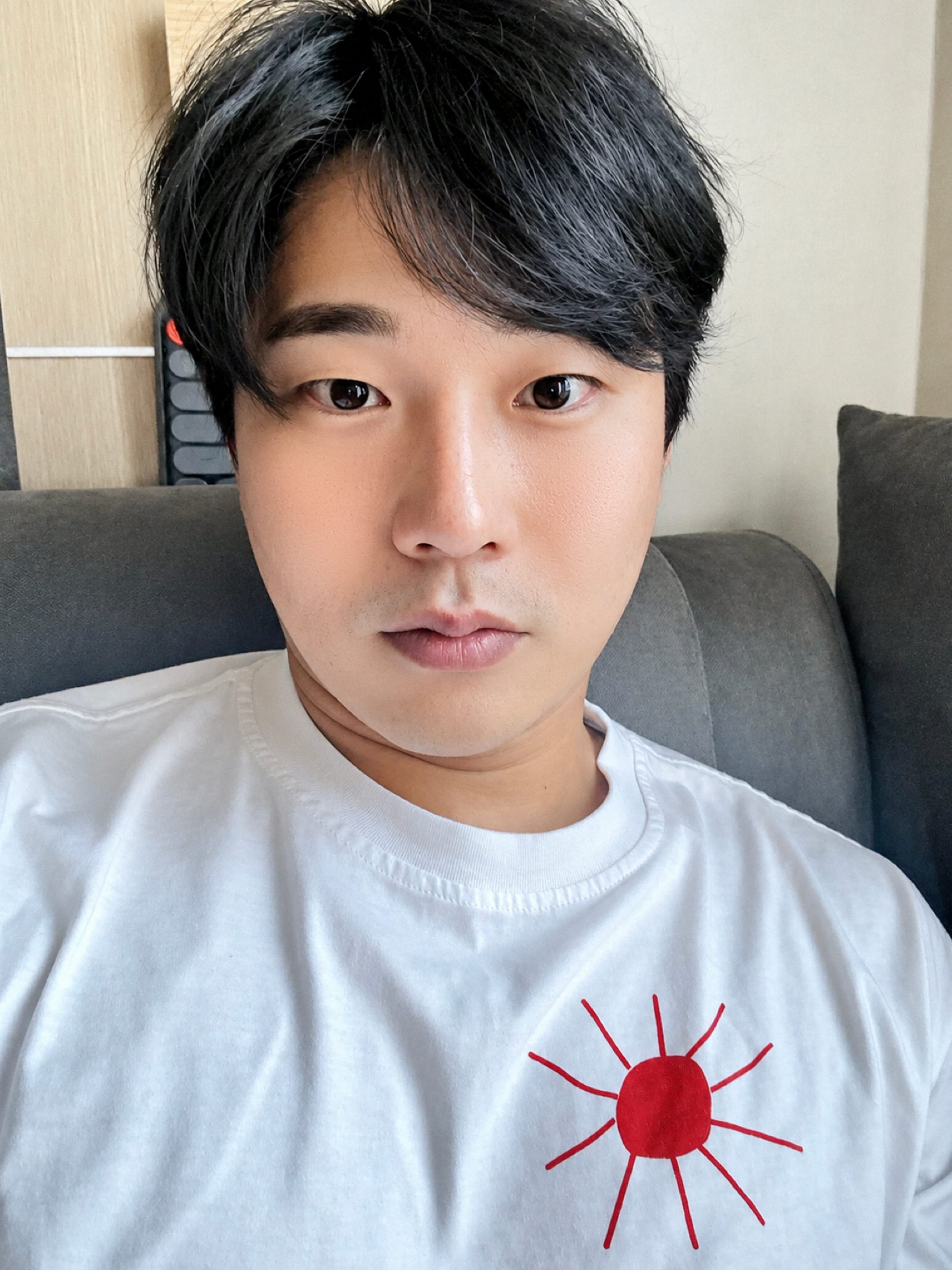 안면거상 수술 후