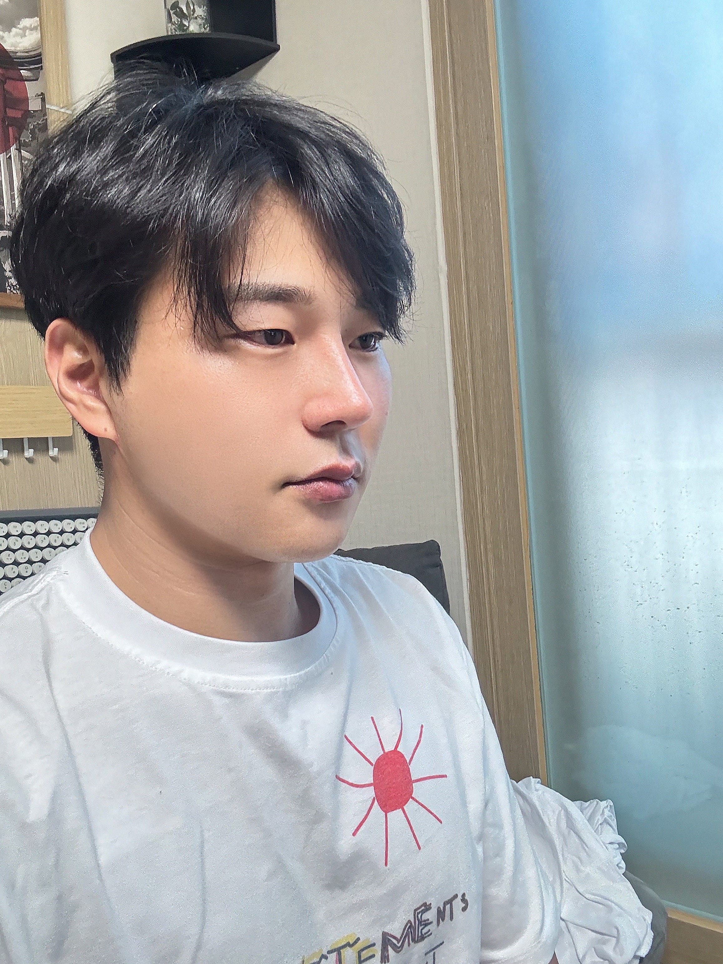 안면거상 수술 후