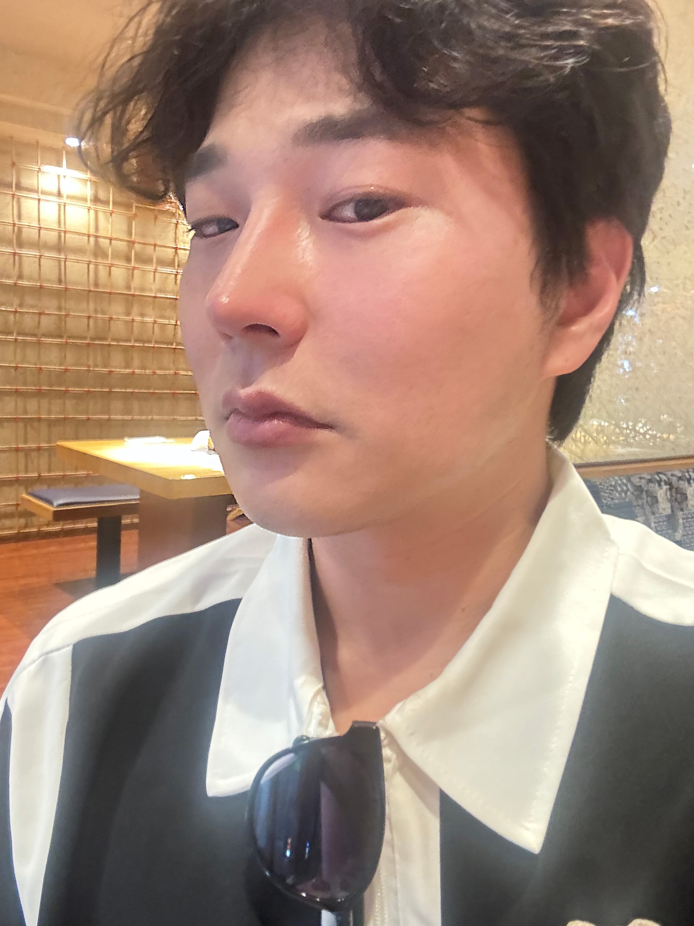안면거상 수술 후