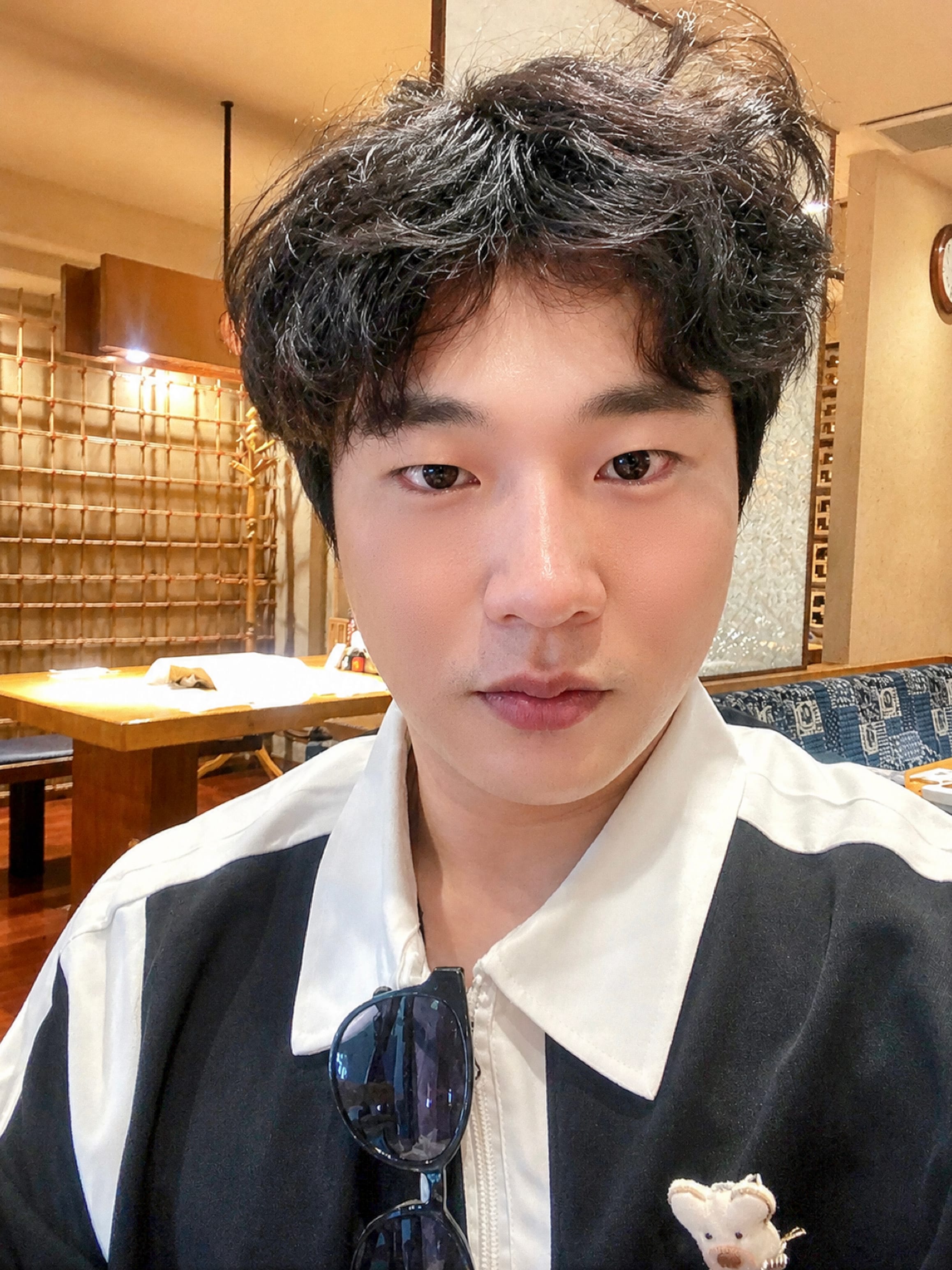 안면거상 수술 후