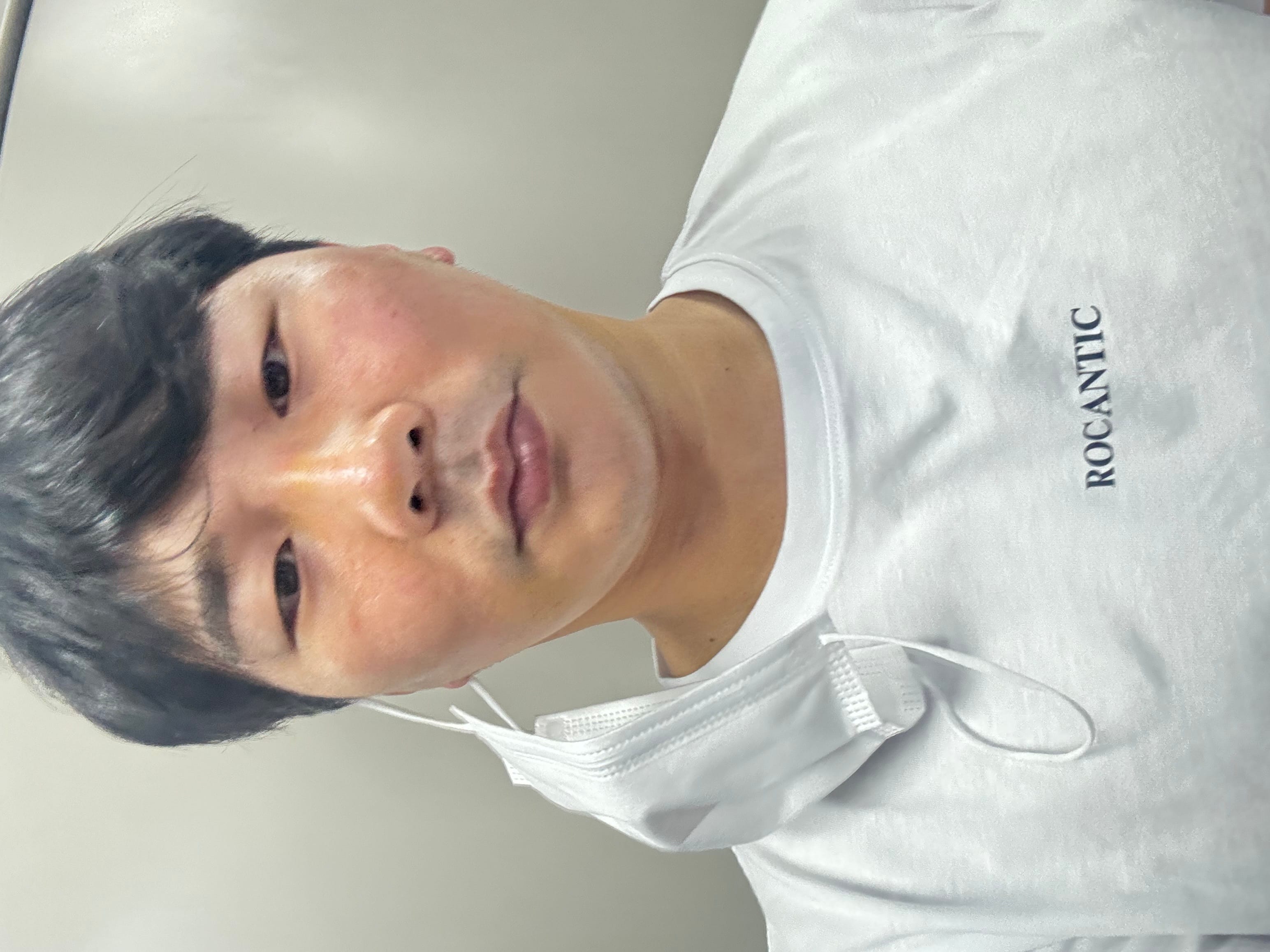안면거상 수술 전