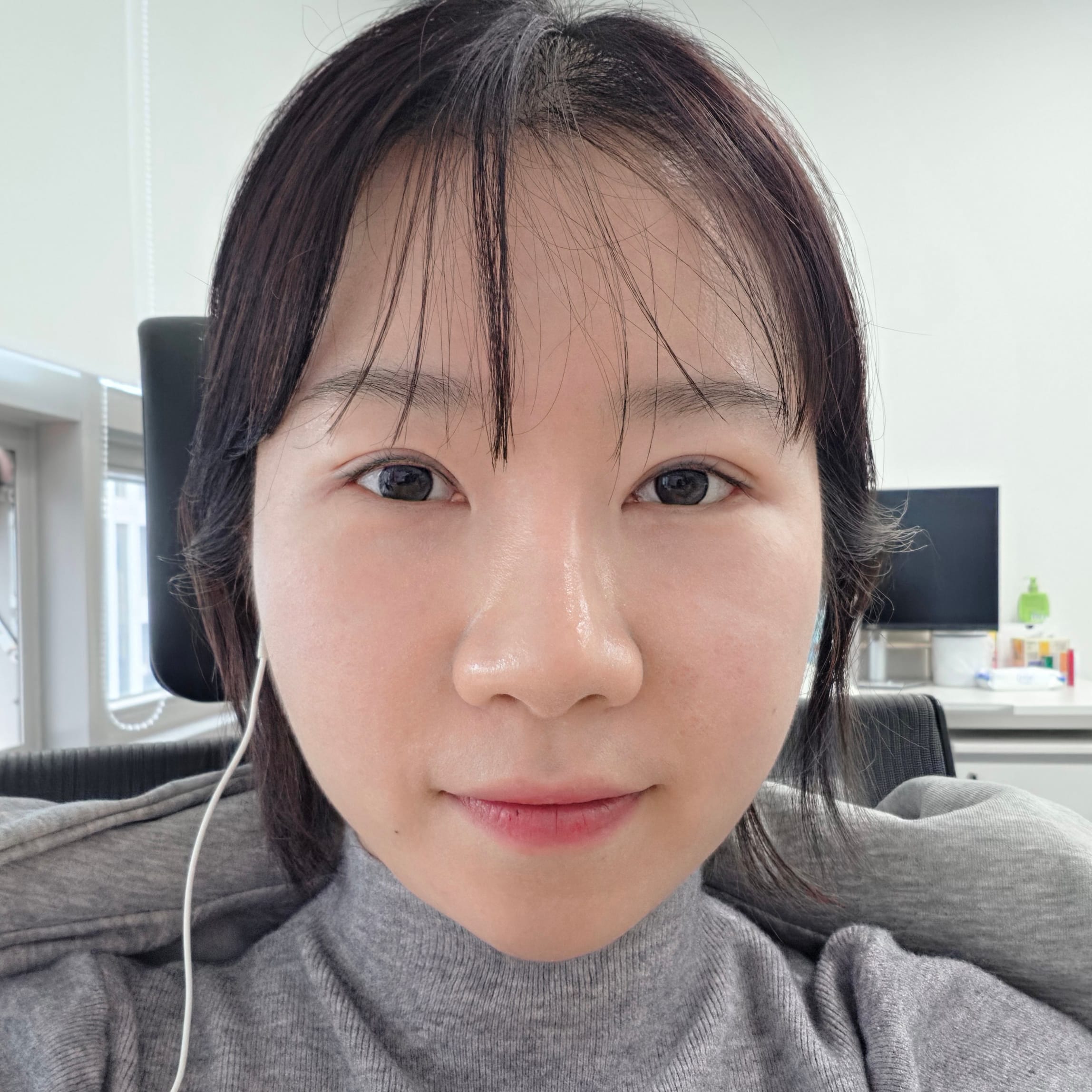 미니거상 수술 후