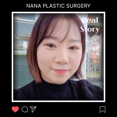 레이저·필러로 안 되던 처짐, 미니거상으로 해결한 후기 썸네일