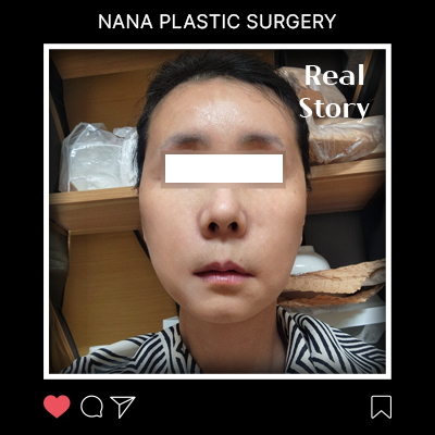 며느리가 선물한 안면거상, 자녀 결혼식에서 빛난 혼주 후기 썸네일