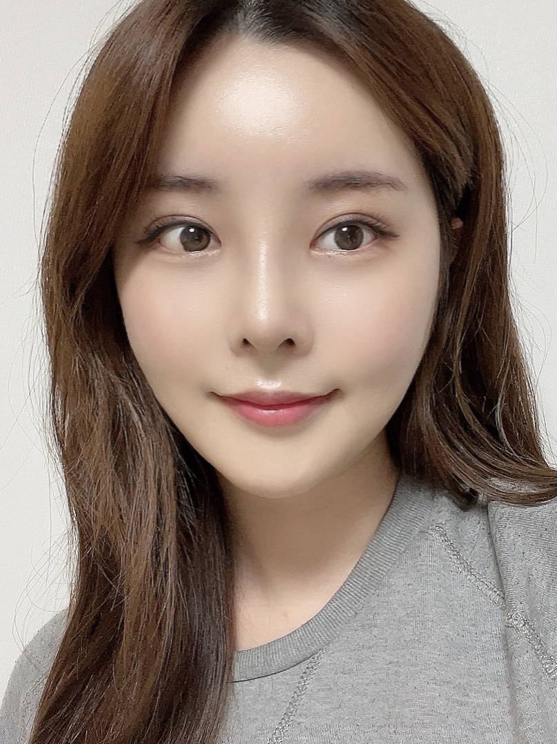 얼굴지방흡입 수술 후