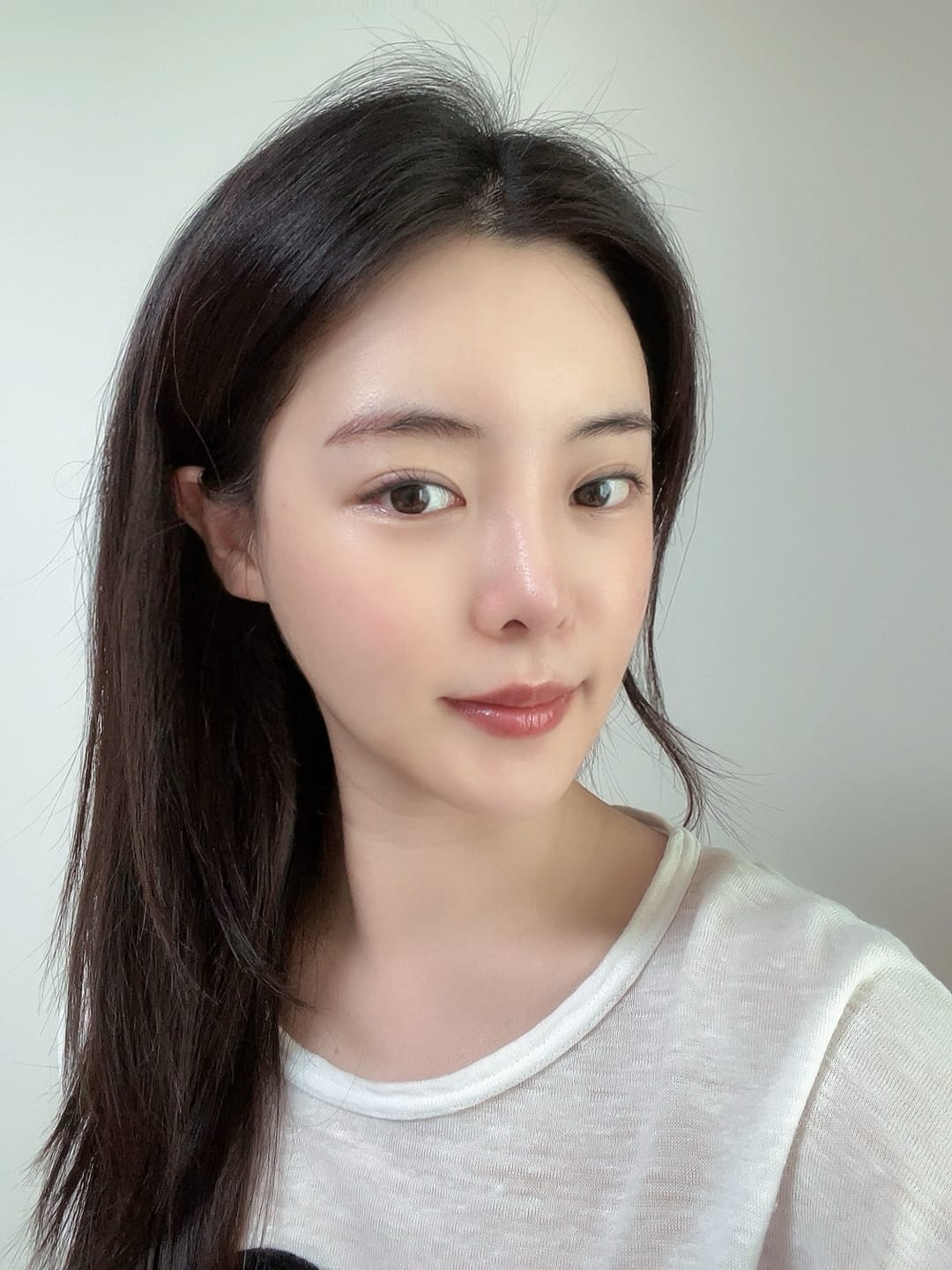 얼굴지방흡입 수술 후
