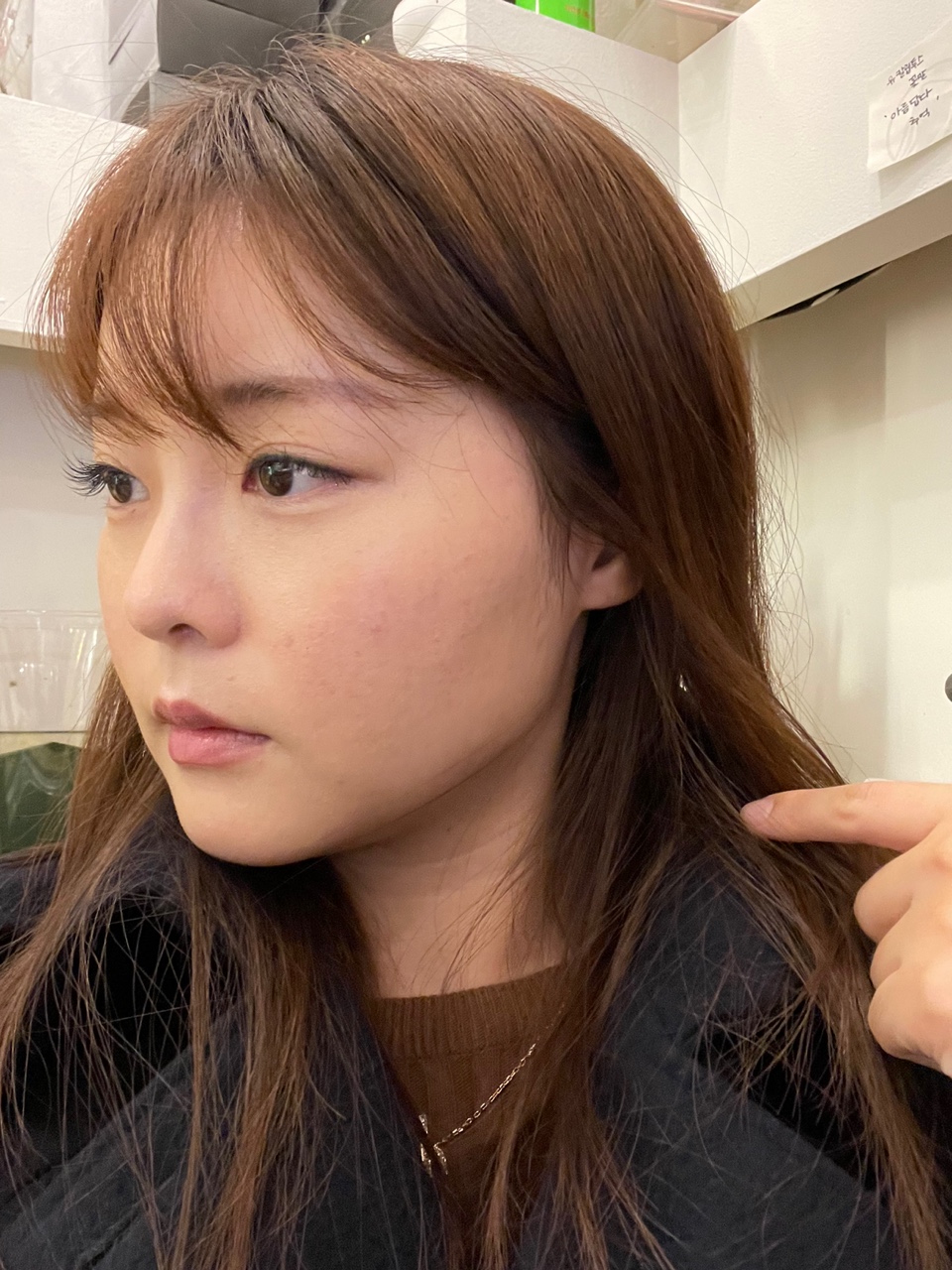 얼굴지방흡입 수술 전
