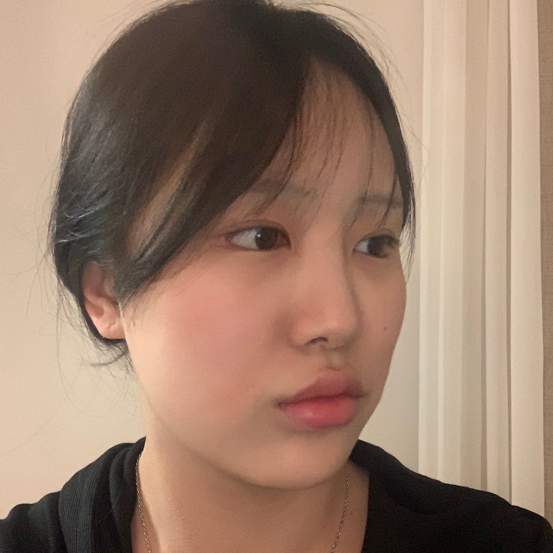 안면거상 수술 전