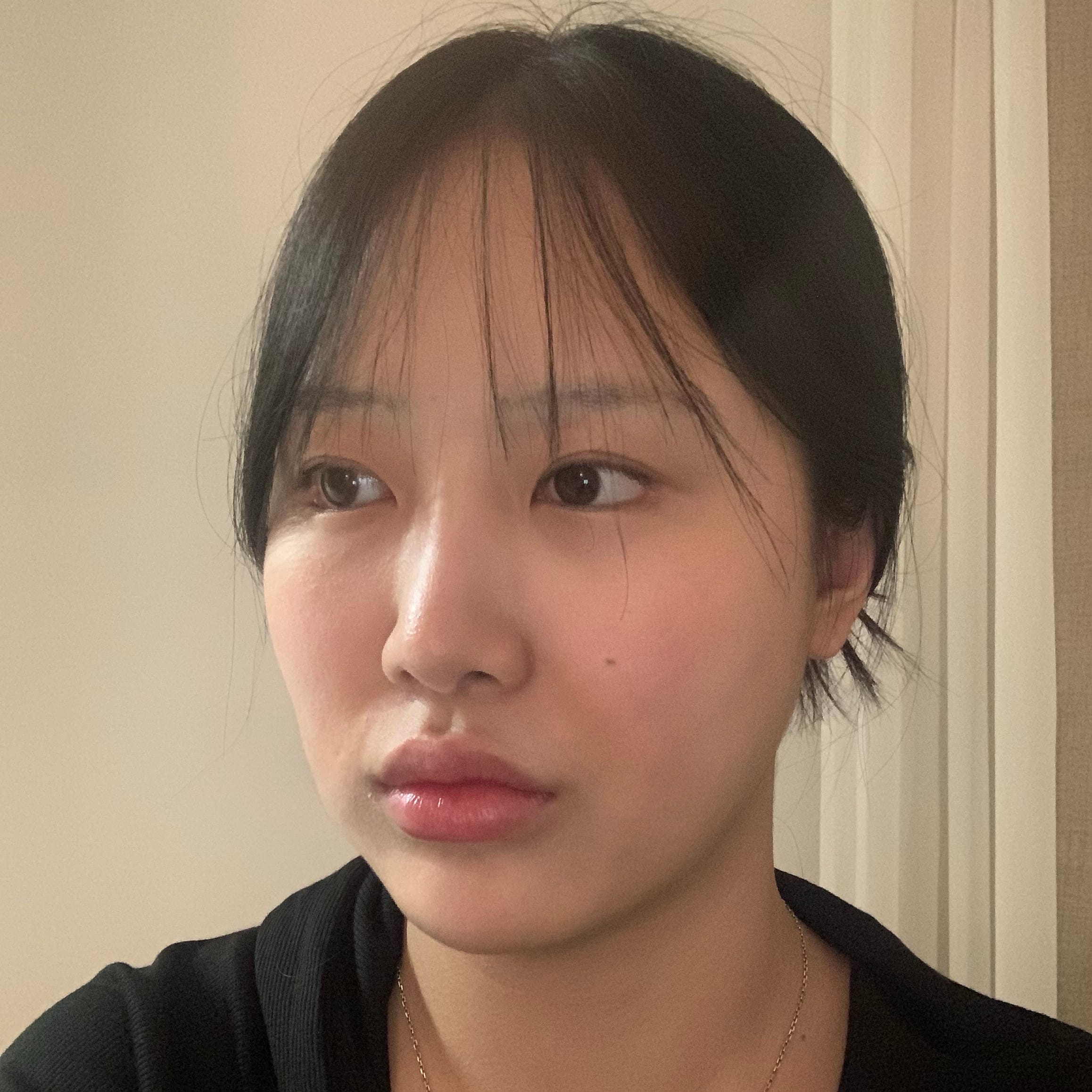 안면거상 수술 전