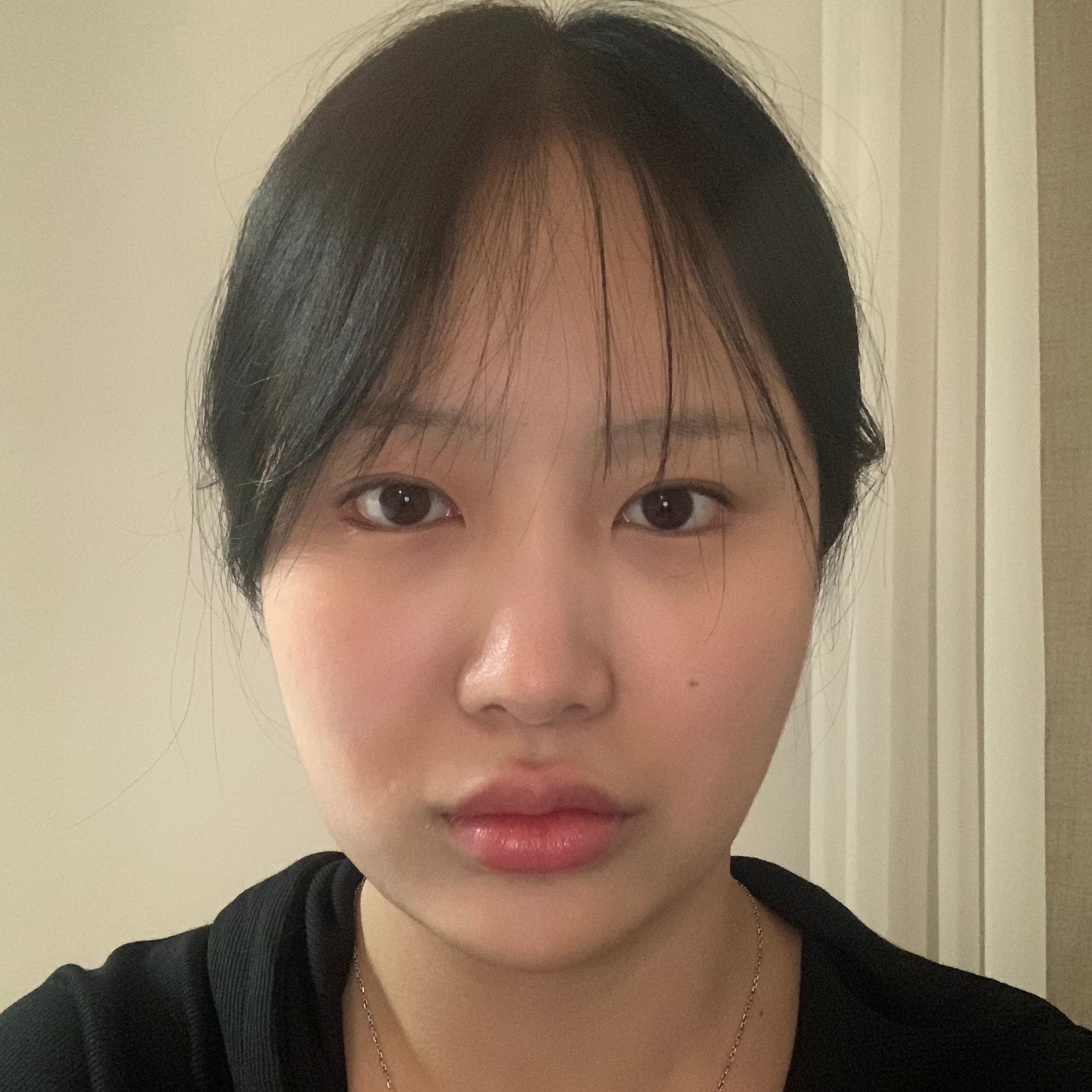 안면거상 수술 전