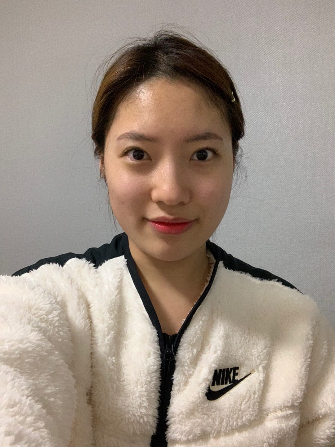 얼굴지방이식 수술 전