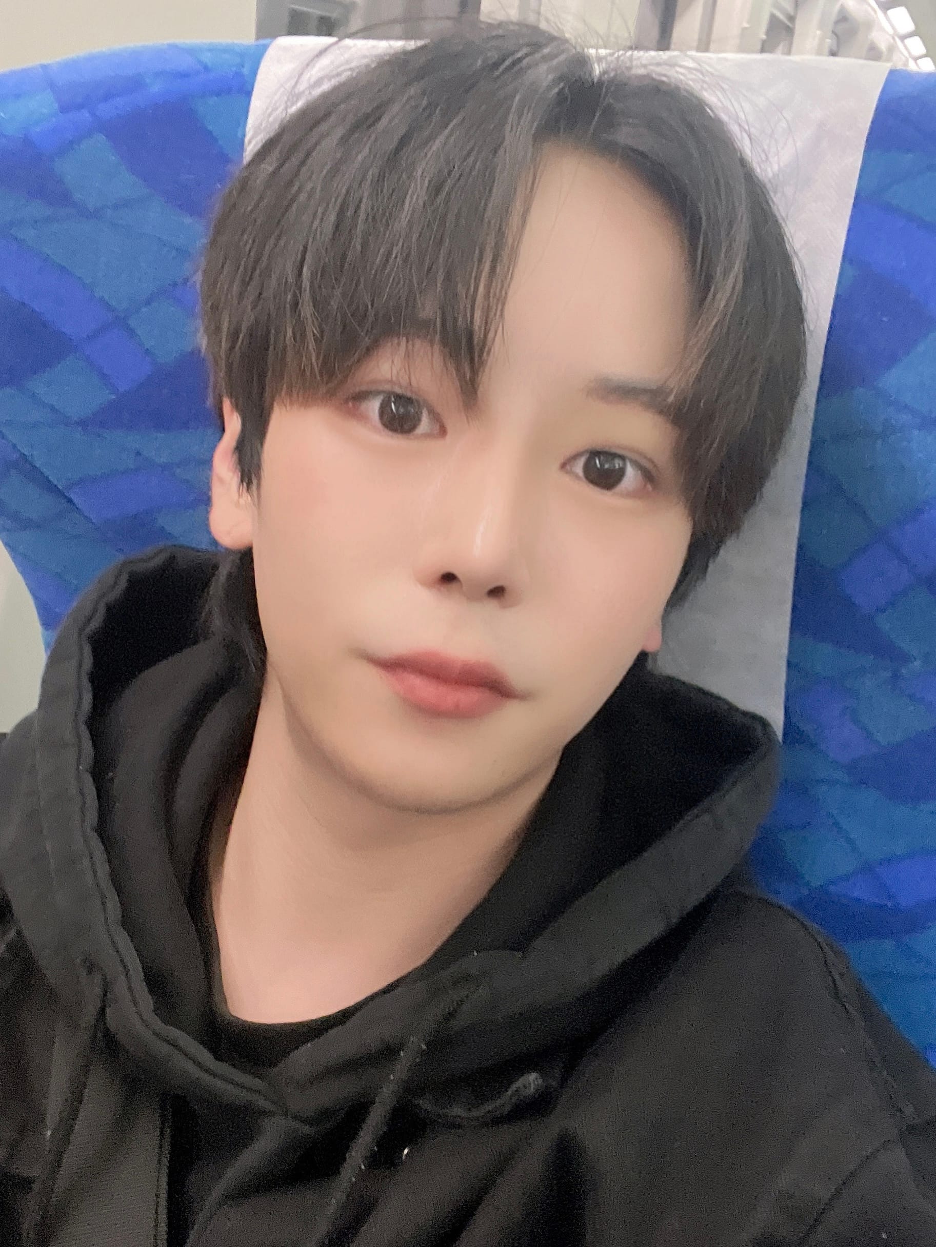 실거상, 코, 심부볼제거 수술 후