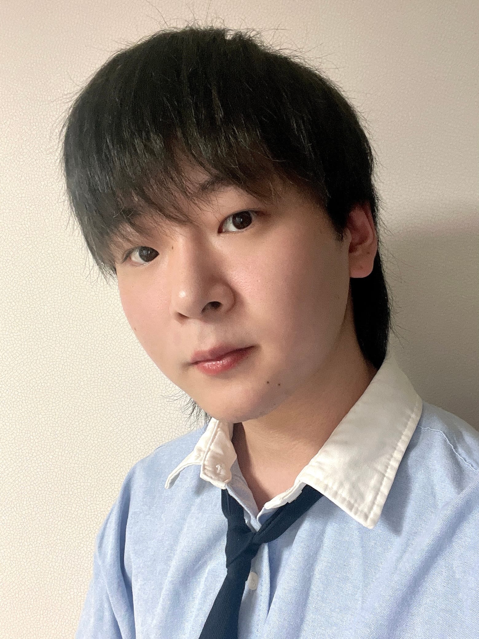 실거상, 코, 심부볼제거 수술 전
