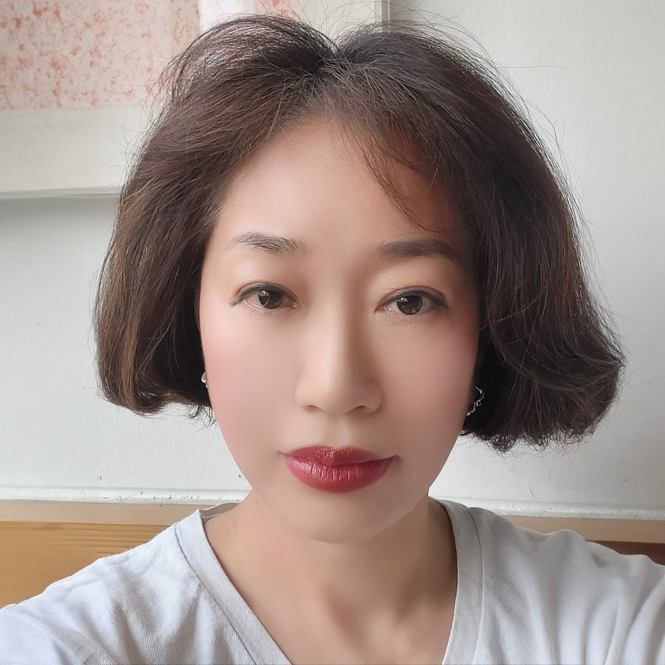 안면거상 수술 후