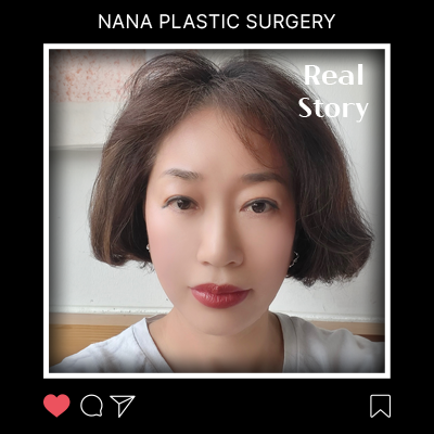 50대 흐릿해진 턱선, 안면거상으로 되찾은 또렷한 인상 후기 썸네일