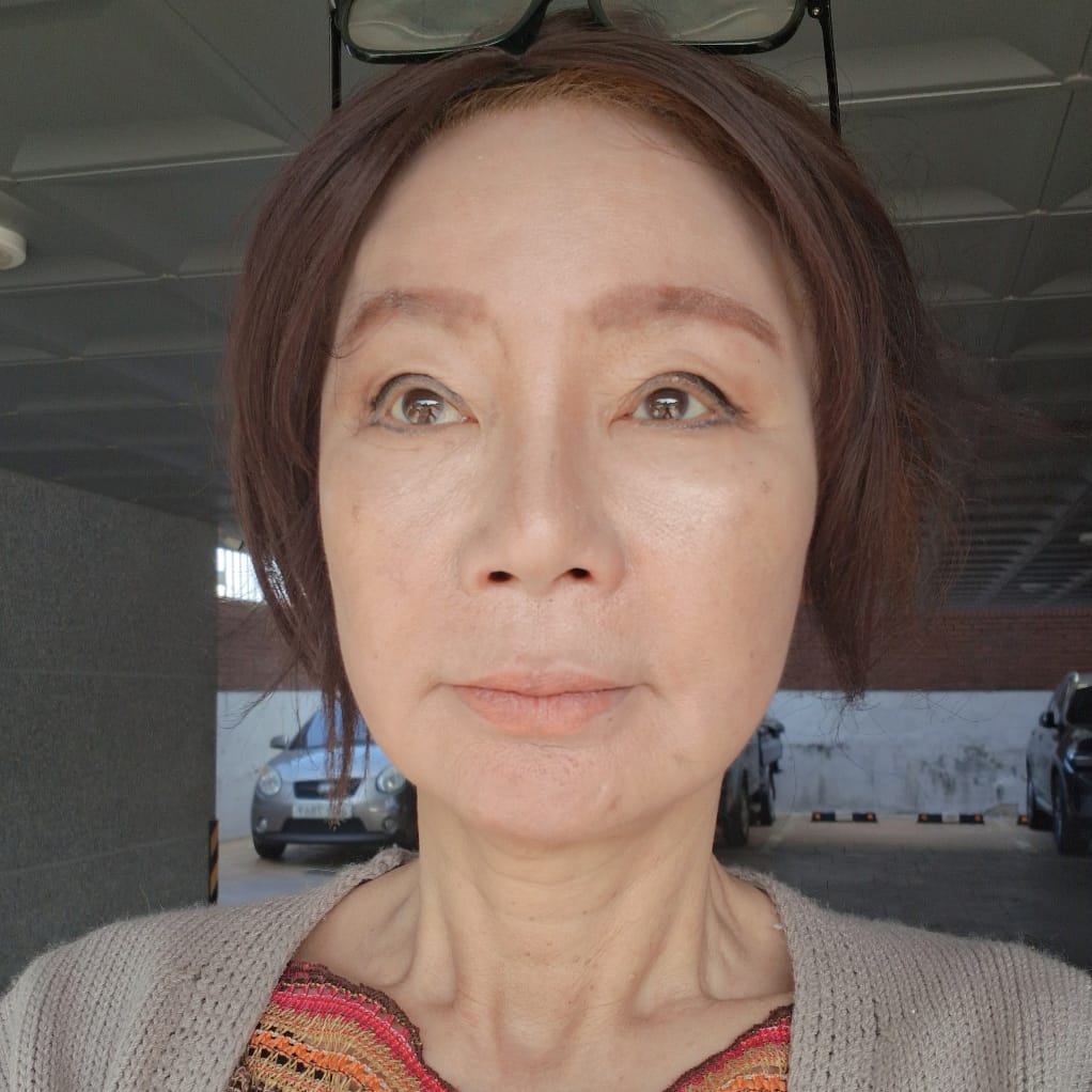 안면거상 수술 후