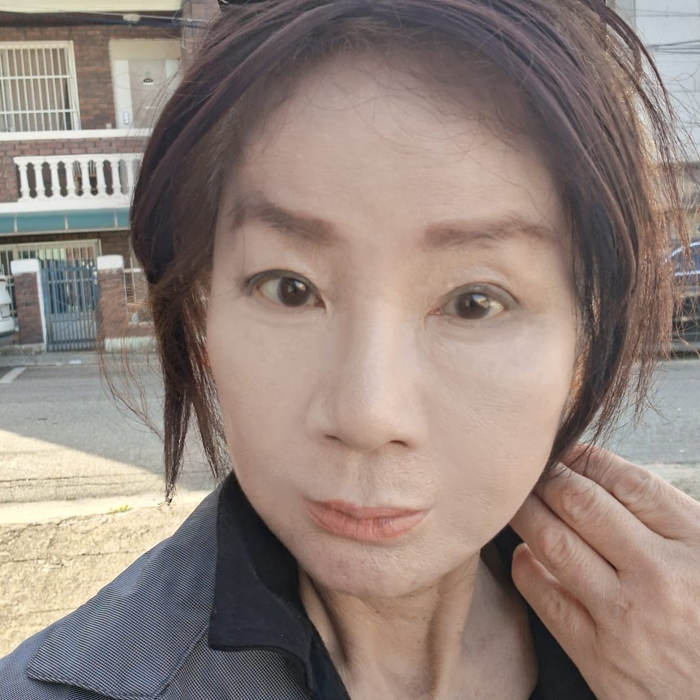 안면거상 수술 후