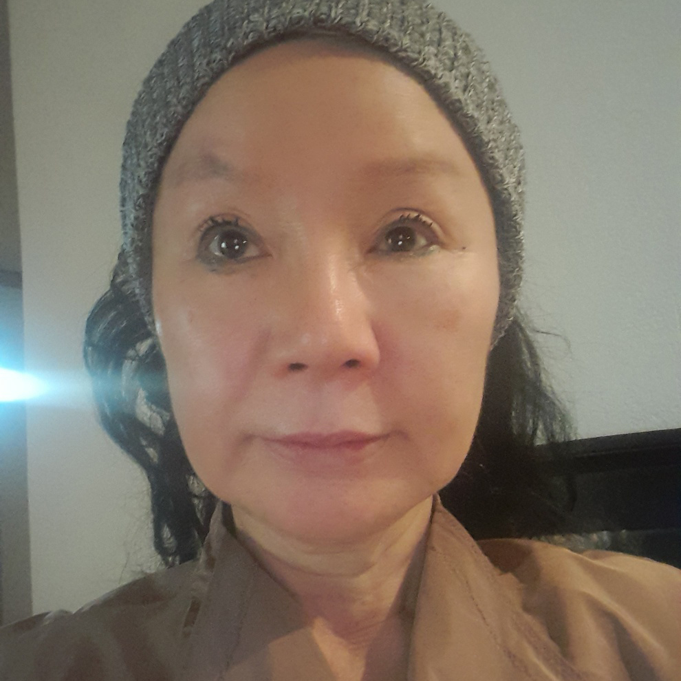안면거상 수술 전
