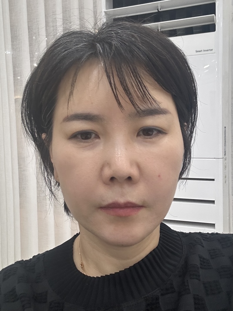 미니거상 수술 전