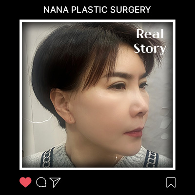 미니거상 리얼후기 썸네일