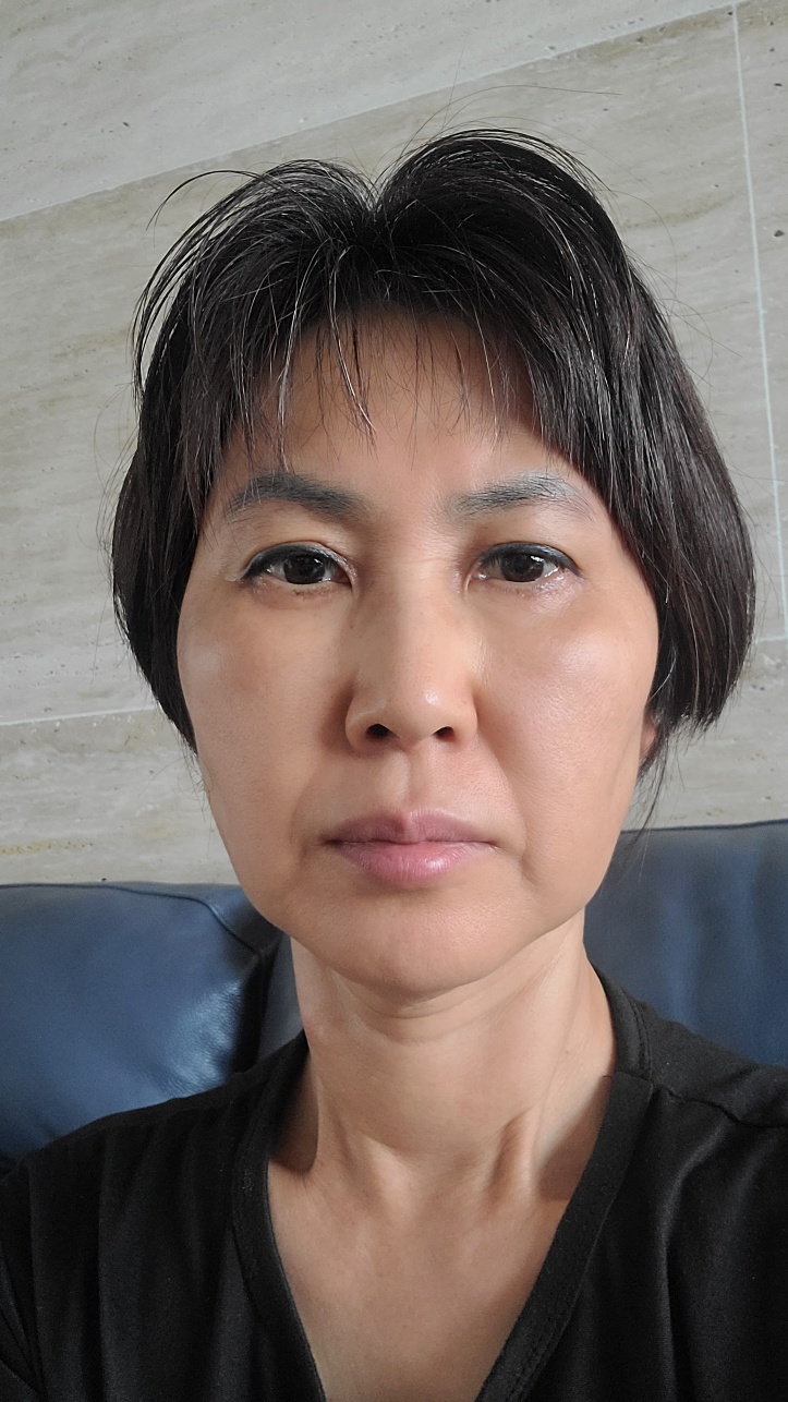 안면거상 수술 전
