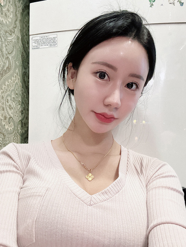 심부볼 수술 후