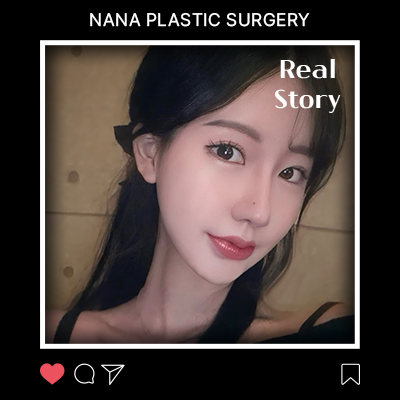 심부볼 리얼후기 썸네일