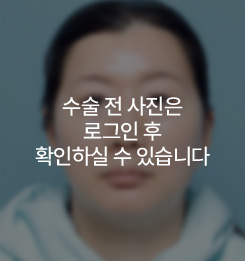 BEFORE 정면