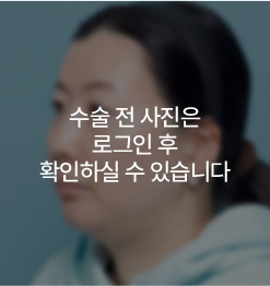 BEFORE 45도